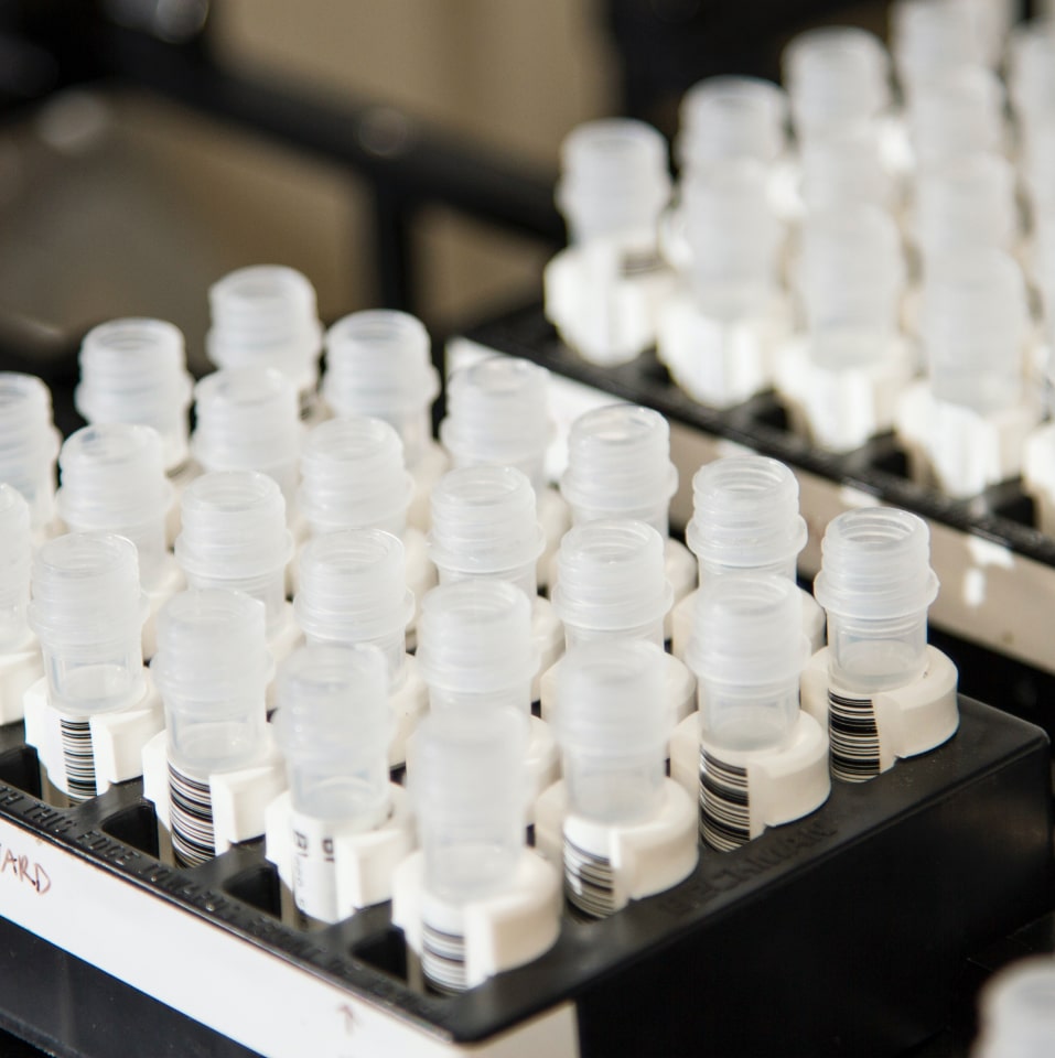 vials arranged for testing